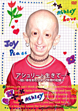 アシュリーと生きて・・・ ~短い命を刻む少女・7年間の記録~